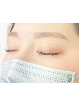 顔脱毛がしたい