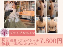 スマイルボディ つぼの森 加治木店(Smile body)の雰囲気（結婚式/撮影直前/イベント前の駆け込みエステもお任せください♪）