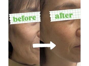 パシュート(pursuit)/before after