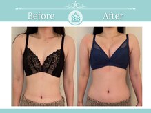 美人バスト 浜松店/◇ バストアップ &nbsp;BeforeAfter◇