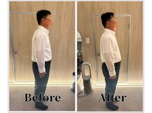 整体ラルース 中目黒(LALUZ)/40代　男性　巻き肩、猫背改善