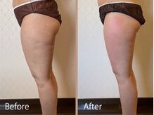 ライトウェーブ 松本村井本店/フォースカッター8回の変化