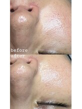 プラスボーテ 幡ヶ谷(plus beaute)/ララピール×エステダーマ幡ヶ谷