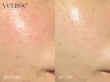 ヴェリス 福岡店(Velisse)/