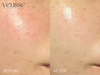 ヴェリス 福岡店(Velisse)/