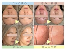 バーガルサロンギンザ(VAGAL SALON GINZA)の雰囲気（結果重視の施術で1回でもしっかりと効果を実感いただけます。）