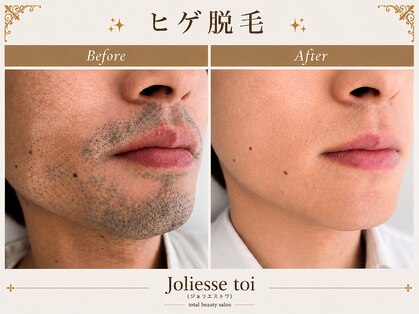 ジョリエストワ(Joliesse toi)の写真