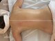 リスト(Rist TOTAL BEAUTY)の写真/吸引マシンで身体の癒着をはがし温めることで、リンパの巡りを整え理想の脚線美へ♪