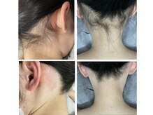 テンピスモ(tempismo)の雰囲気(ワックスと光脱毛でしっかりお手入れ→自然な形に整えていきます)