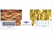 フェイシャルスタイリストサロン 四谷店/ケア例（30）