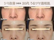 レオン(REONE)/【30代からの美肌作りが得意◎】