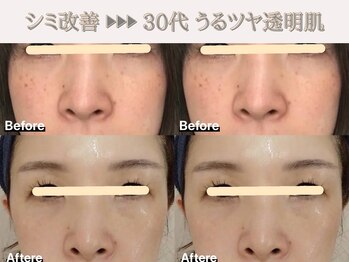 レオン(REONE)/【30代からの美肌作りが得意◎】