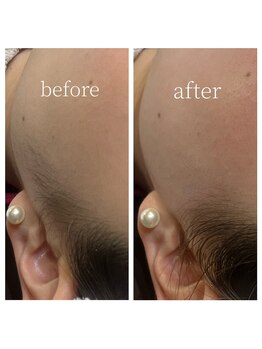 ブライズ(BRISE)/フェイシャルワックス☆¥8800