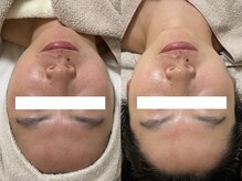 ステムサロン(stem salon)/ビフォーアフター