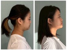 テルケル 佐賀/