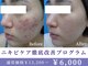 エピア 岡崎店(Epia)の写真