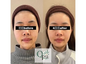 キュープ 鹿児島伊集院店(Qpu)/