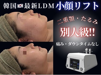 センシズ(Senses)の写真