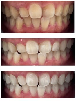 ホワイト オン(WHITE ON)の写真/仕事帰りに立ち寄れる♪初めてでもサポート。新しい自分に出会いませんか？