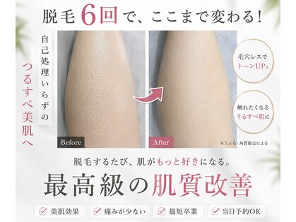 ミーシェ(Meshie)の写真