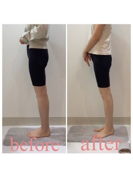 スタイルラボ高松/産後骨盤矯正の効果♪