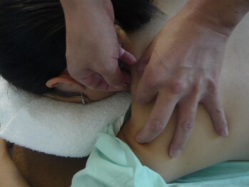 アタック鍼灸院(ATAC鍼灸院)/肩への刺鍼