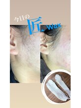 チャーム(CHARM∞)/もみあげスッキリ