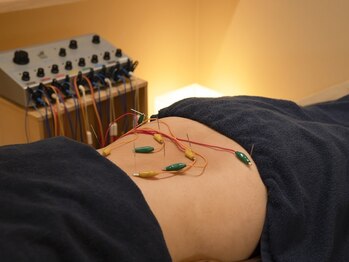 たくろう鍼灸院 豊田本院の写真/おすすめ◎【オーダーメイド鍼灸施術 60分】腰痛、首肩コリ、頭痛などあらゆるお悩みに合わせてケア◎