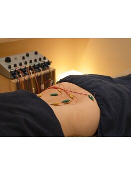 鍼灸施術を受けたい