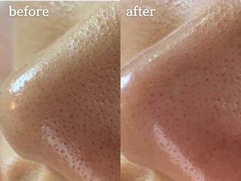 メルシア(merucia)/