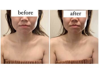 スラン(Slan)/輪郭チェンジ★