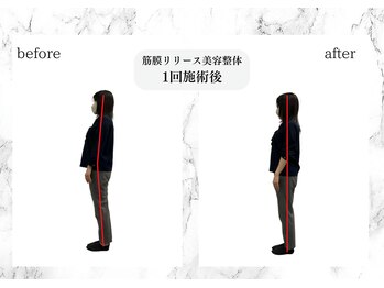 トキ(TOKI)/筋膜リリース美容整体 施術直後