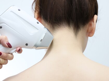 チャッピー(CHAPPY)の写真