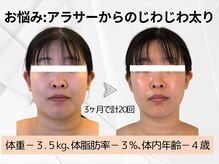 ヨサパーク ラ ぺ(YOSAPARK La paix)