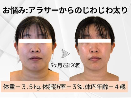 ヨサパーク ラ ぺ(YOSAPARK La paix)の写真