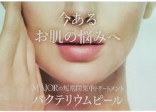 フィオーレ