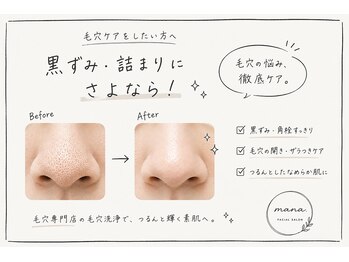マナ(mana)の写真/【毛穴専門店】黒ずみ・詰まりを徹底ケア◎毛穴洗浄30分6500円→5500円初回価格