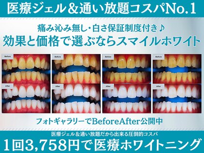スマイルホワイト 赤羽店の写真