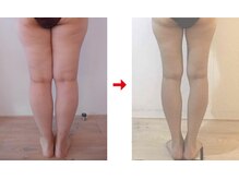 フォーレディ 恵比寿店/ふくらはぎ★-6.3ｃｍ