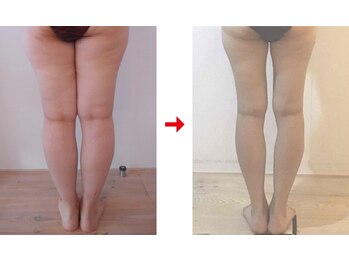 フォーレディ 恵比寿店/ふくらはぎ★-6.3ｃｍ