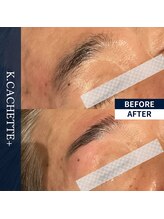 ケードット カシェットプラス(K.CACHETTE+)/アイブロウ　ビフォーアフター