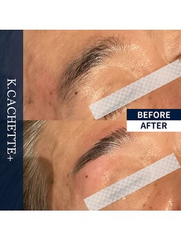ケードット カシェットプラス(K.CACHETTE+)/アイブロウ　ビフォーアフター