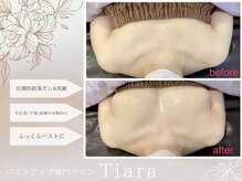 ティアラ(Tiara)