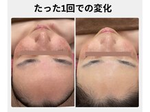ルノン(LUNON)の雰囲気（酵素洗顔とセルマン角質整理で透明感のある艶玉肌に！）