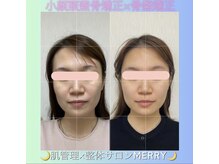 メリー 大和八木店(merry)/お顔の左右差を整えます★