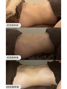 テネル 池袋(TENER)/