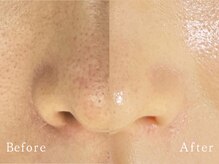 クリアー(CLEAR.)/【Before＆After】