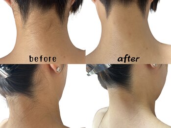 プラスシェーブ(plus shave)/うなじはお任せください♪