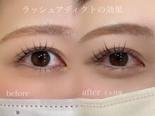 アン フェミン(une FEMIN)/【ラッシュアディクトの効果】