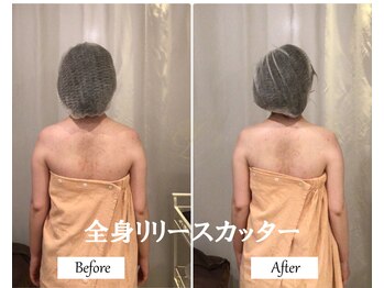 リノ(Lino)/全身リリースカッター◎